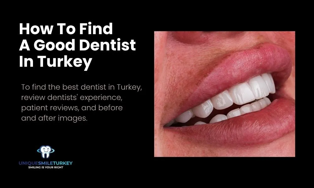 How To Find A Good Dentist In Turkey