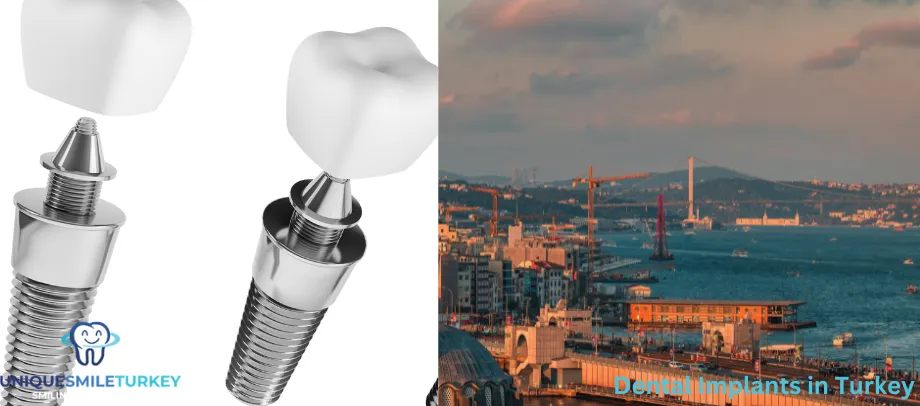 dental implants in Turkey