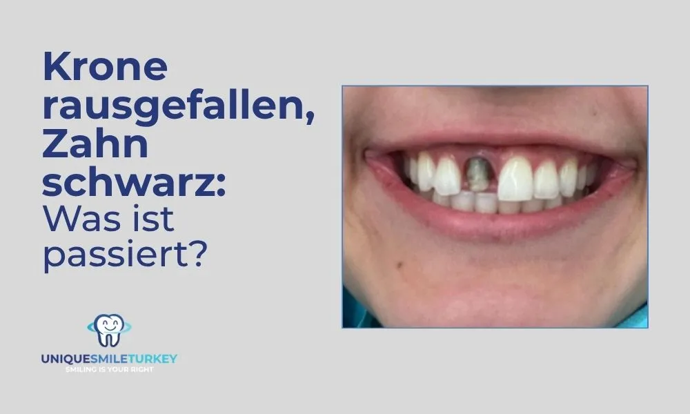 Krone rausgefallen, Zahn schwarz