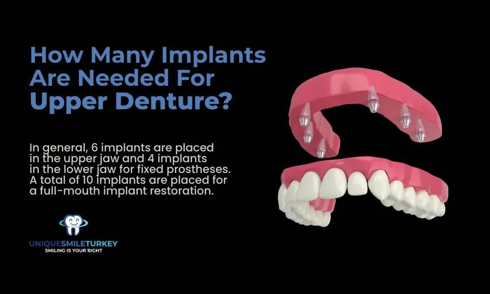 How many implants are needed for upper denture?