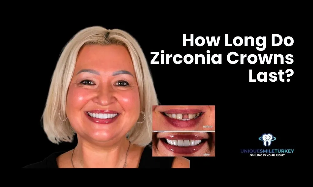 How long do Zirconia crowns last? How long do Zirconia crowns last Antalya?
