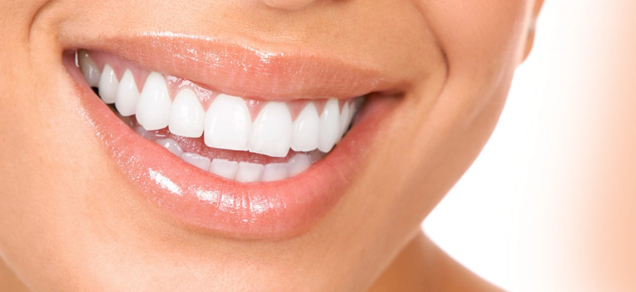 Teeth Whitening in Turkey