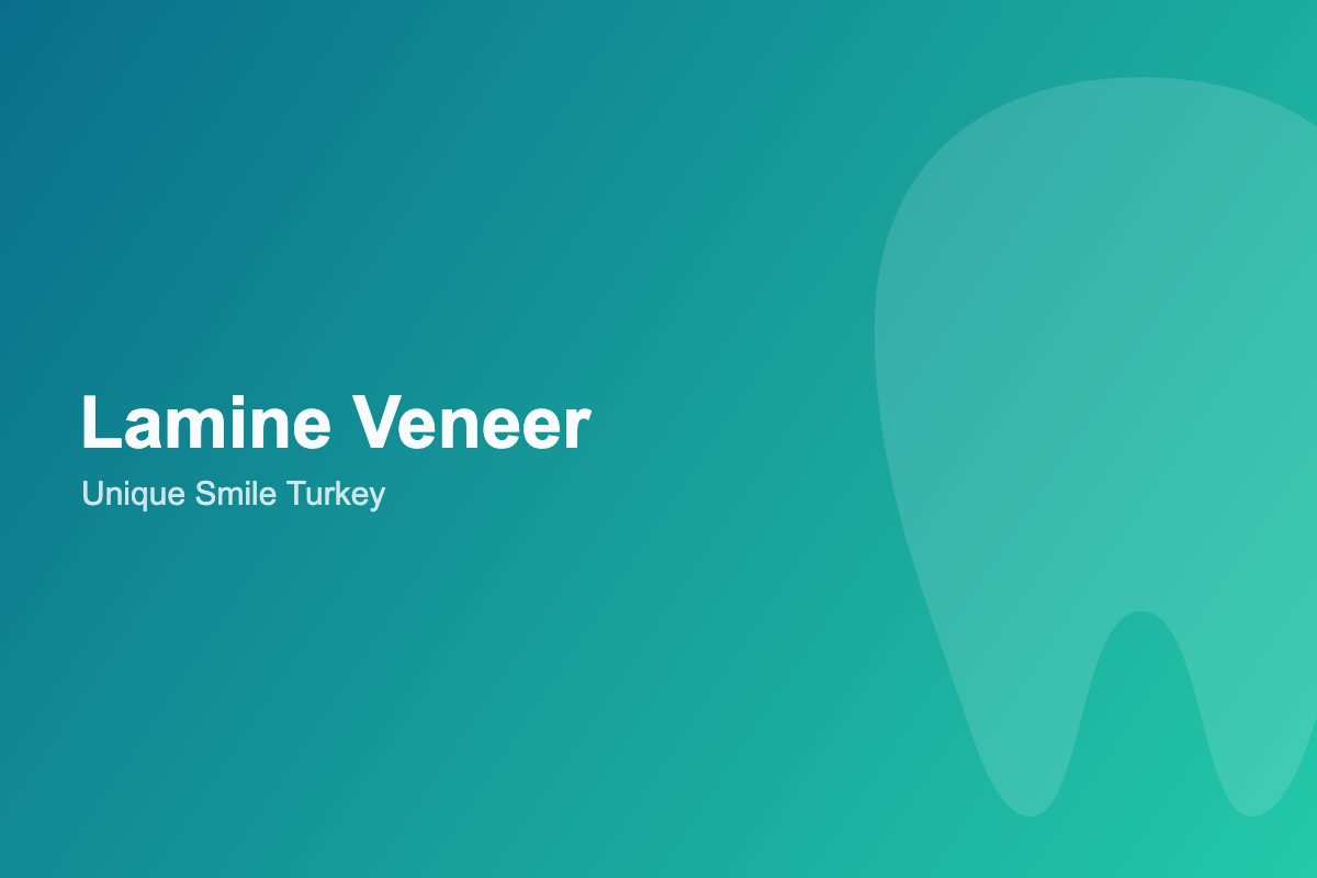 Lamine Veneer Dişlerin Ömrü ve Bakımı