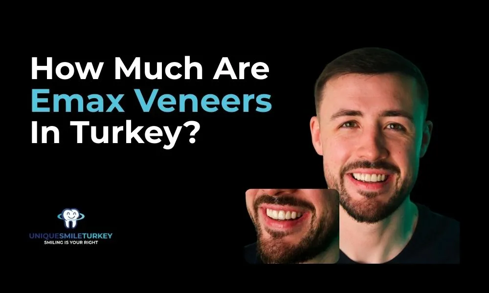 Emax veneers in Turkey