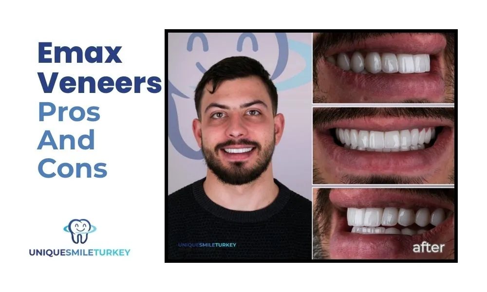 Emax veneers in der Türkei