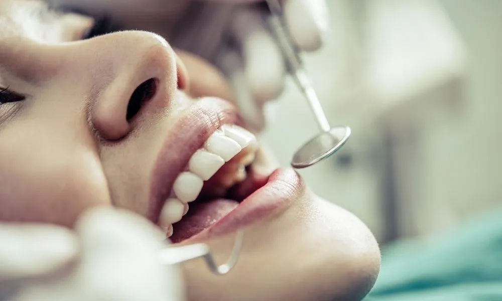 Non-prep Veneers Türkei